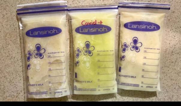 susu-ibu-muda-di-meksiko-ini-berubah-jadi-warna-hijau-neon-saat-dia-dan-bayinya-terinfeksi-covid-19