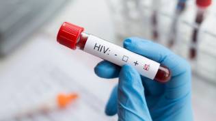 angka-kasus-hiv-aids-tinggi-pemkot-bandung-akan-lakukan-pendataan-lebih-rinci