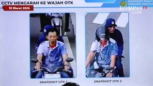 rscm-ungkap-kondisi-terkini-andrie-yunus-tim-medis-temukan-adanya-kondisi-iskemia-pada-mata-kanan