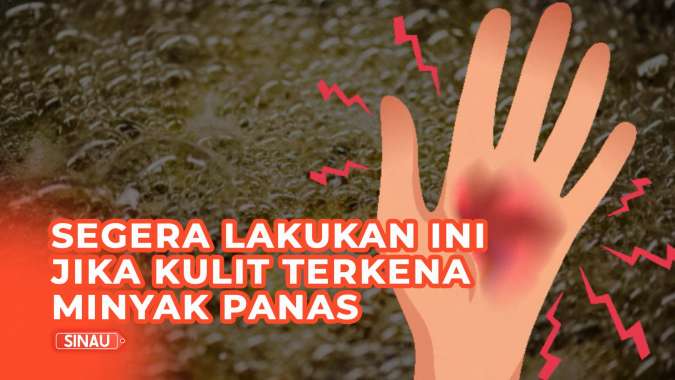 Gambar Tangan Kena Air Panas