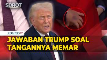 Jawaban Trump Soal Tangannya Terlihat Memar Saat Acara World Economic Forum