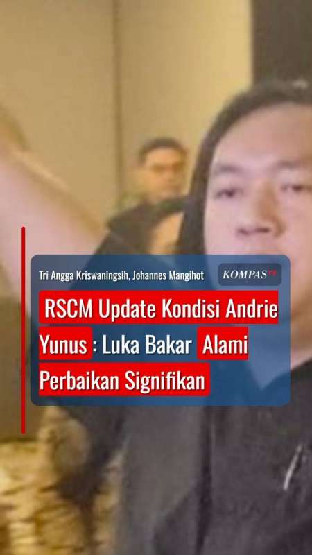 RSCM Update Kondisi Andrie Yunus: Luka Bakar Alami Perbaikan Signifikan