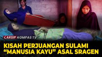 Intip Lagi Kisah Sulami “Manusia Kayu” Asal Sragen Lawan Penyakit Jadi Sorotan Dunia – ARSIP KOMPAS