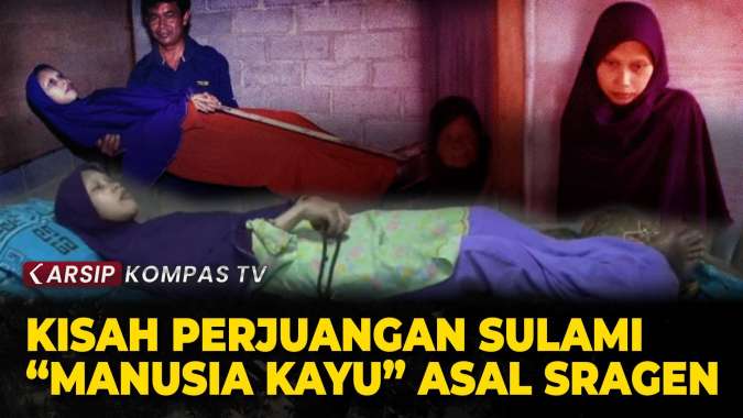 Intip Lagi Kisah Sulami Manusia Kayu Asal Sragen Lawan Penyakit Jadi ...