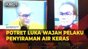 Potret Luka Wajah Terdakwa Penyiram Air Keras Ke Andrie Yunus Ditampilkan Di Sidang