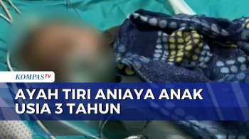 Balita 3 Tahun Di Solok Dianiaya Ayah Tiri, Dirawat Intensif Di Rumah Sakit | KOMPAS SIANG