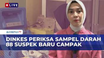 Temuan 88 Suspek Baru Campak Diperiksa Dinas Kesehatan Kota Makassar | SAPA SIANG